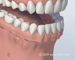 The image shows a 3D rendering of an open mouth with white teeth and a pink tongue, set against a light blue background.