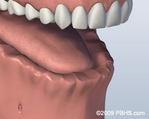 The image shows a close-up view of an open mouth with teeth, featuring a lower lip that appears to be part of a medical device or training aid.