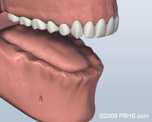 The image shows a close-up 3D rendering of an open human mouth with teeth, tongue, and lips visible.