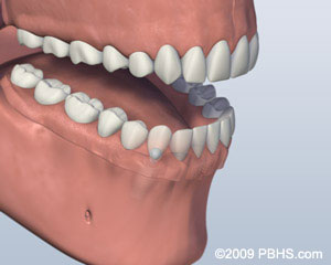 The image shows a 3D rendering of a human mouth with teeth, which appears to be part of an educational or medical context.