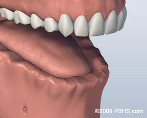The image shows a close-up view of an open mouth with visible teeth and tongue, focusing on the lower lip and chin area.